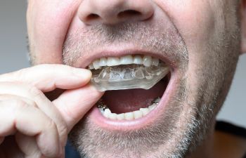 A man inserting a dental mouth guard