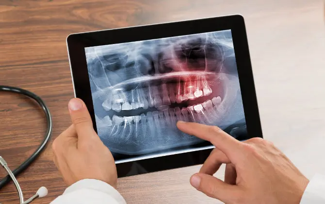 Dentist reviewing dental X-rays on a tablet