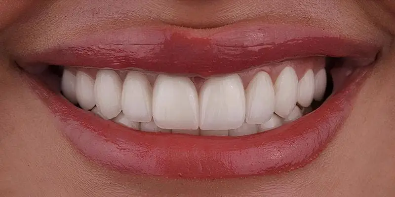 dental-image-after